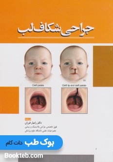 جراحی شکاف لب