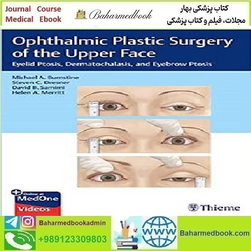 Ophthalmic Plastic Surgery of the Upper Face Video
