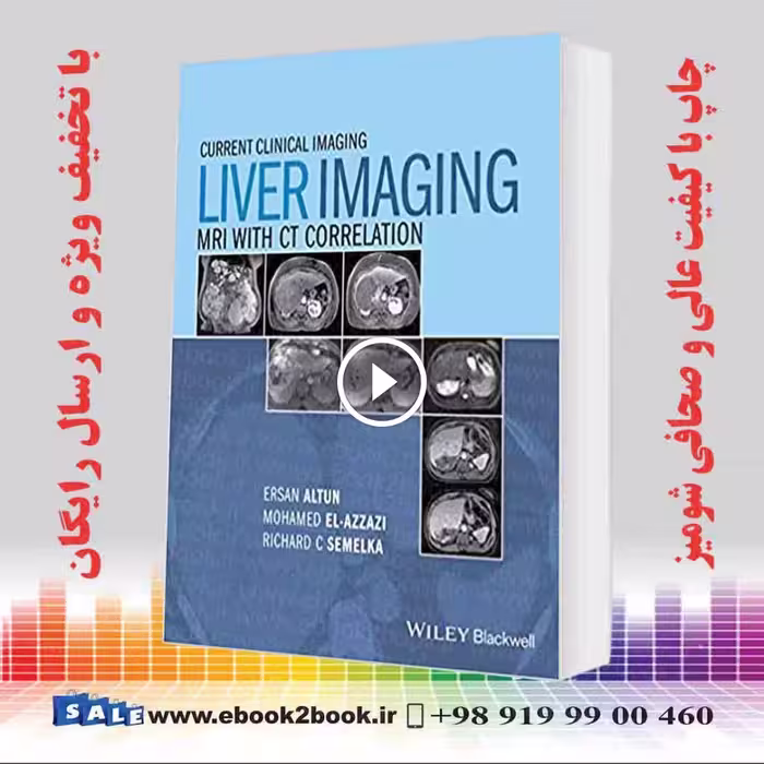 Liver Imaging: MRI with CT Correlation (Current Clinical Imaging)