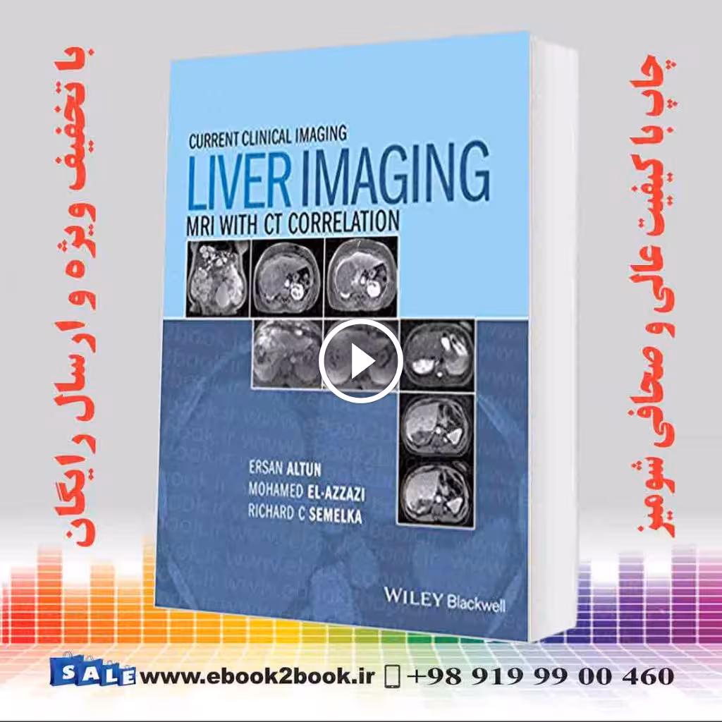 Liver Imaging: MRI with CT Correlation (Current Clinical Imaging)
