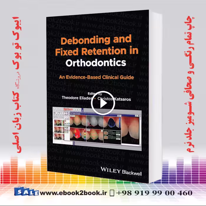 Debonding and Fixed Retention in Orthodontics