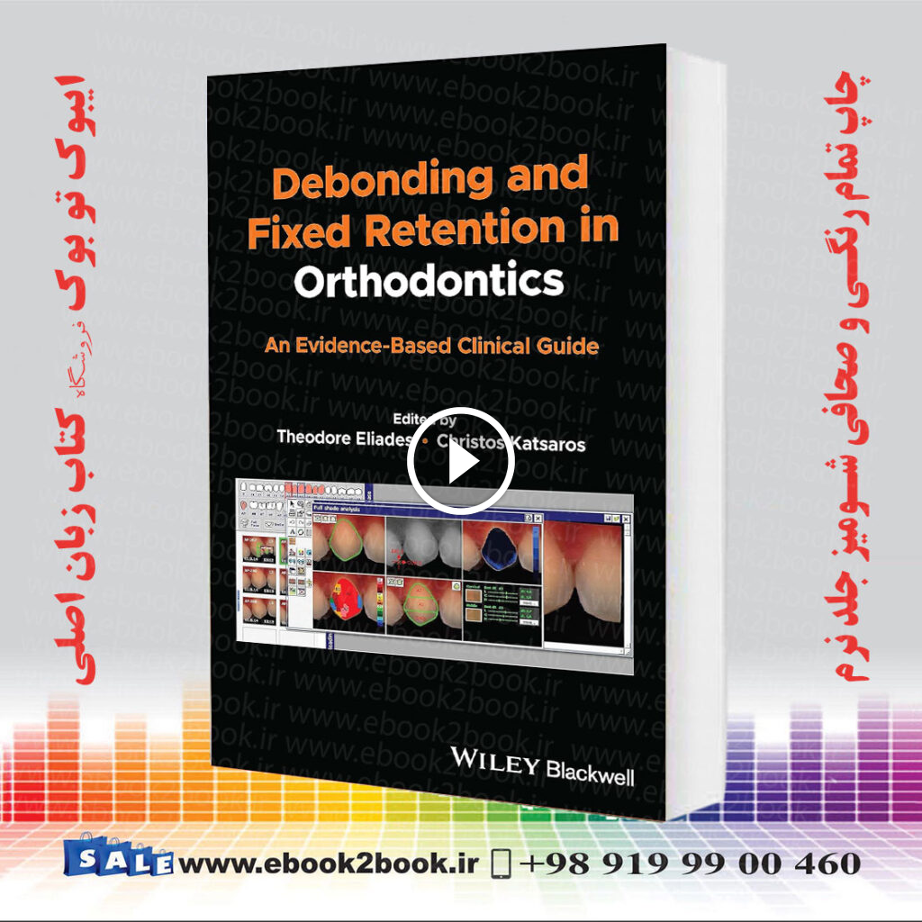 Debonding and Fixed Retention in Orthodontics
