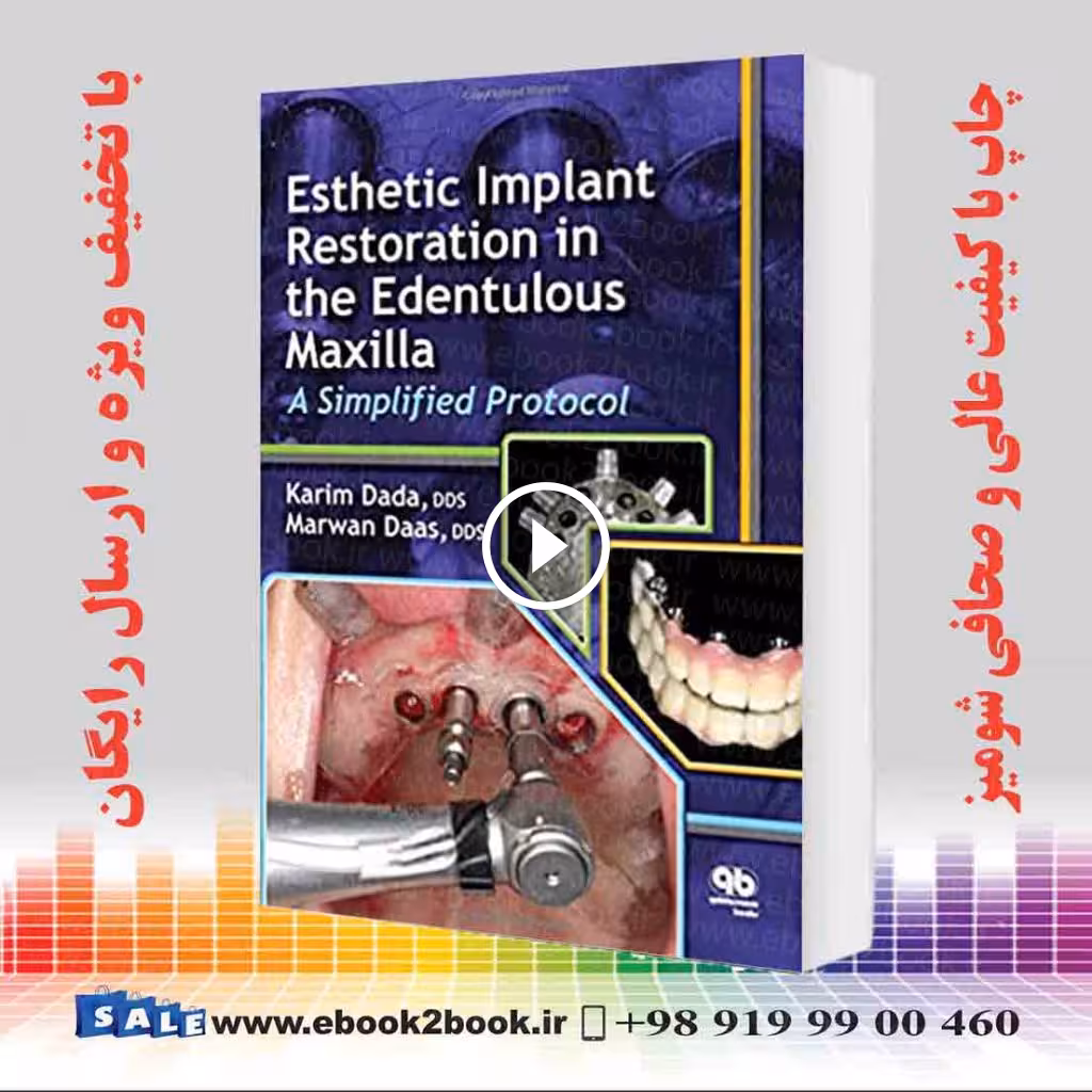 Esthetic Implant Restoration in the Edentulous Maxilla