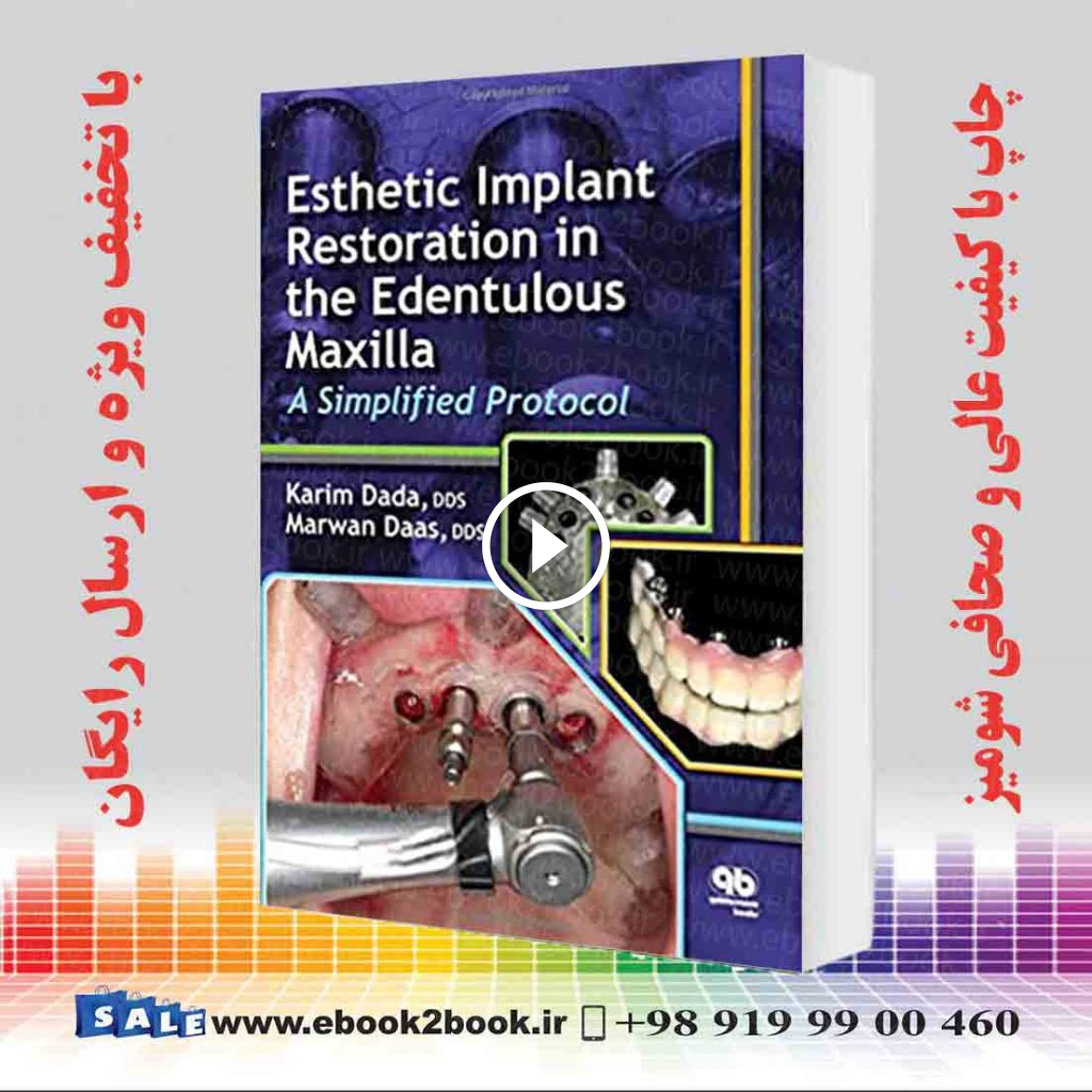 Esthetic Implant Restoration in the Edentulous Maxilla