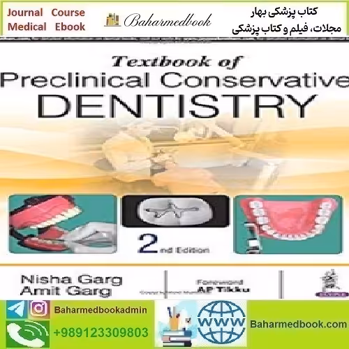 Textbook of Preclinical Conservative Dentistry 2017 T