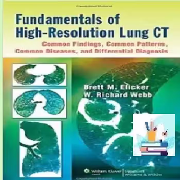 Fundamentals of High-Resolution Lung CT TRUE PDF price 1€
