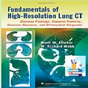 Fundamentals of High-Resolution Lung CT TRUE PDF price 1€
