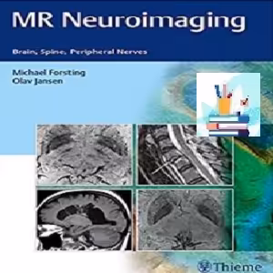 MR Neuroimaging TRUE PDF price 1€