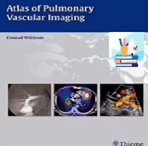 Atlas of Pulmonary Vascular Imaging TRUE PDF price 1€