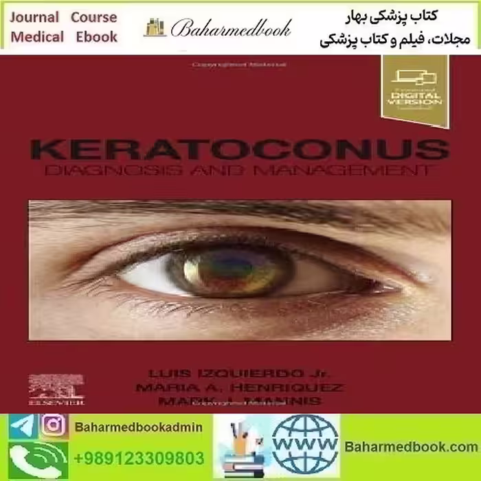 Keratoconus Diagnosis and Management 2023 TRUE PDF price 4€ - کتاب پزشکی بهار