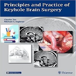 خرید و دانلود کتاب Principles and Practice of Keyhole Brain Surgery 1ed