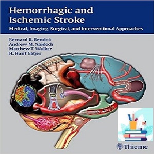Hemorrhagic and Ischemic Stroke Medical Imaging Surgical and Interventional Approaches 1ed PDF Videos at 2€ - کتاب پزشکی بهار