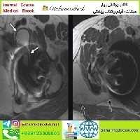 ARRS Controversies in Hip and Pelvis Imaging 2016 video cou
