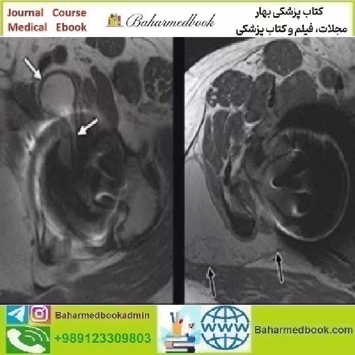 ARRS Controversies in Hip and Pelvis Imaging 2016 video cou
