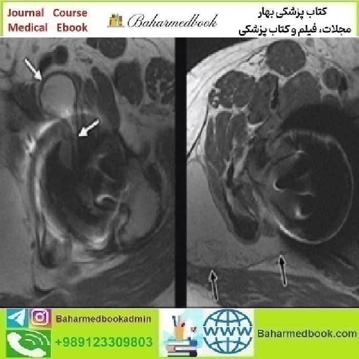 ARRS Controversies in Hip and Pelvis Imaging 2016 video cou