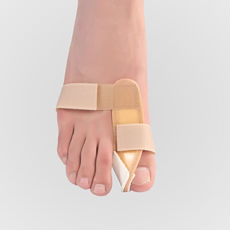 اسپلینت هالکوس والگوس نرم