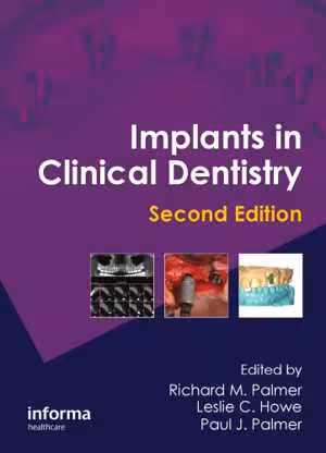 [PDF] دانلود کتاب Implants In Clinical Dentistry, 2nd ed, 2011