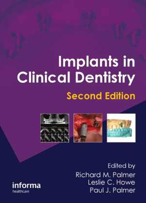 [PDF] دانلود کتاب Implants In Clinical Dentistry, 2nd ed, 2011