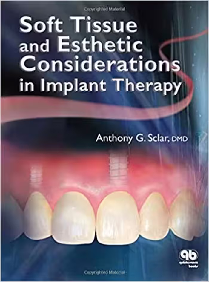 󾕇 دانلود کتاب Soft Tissue And Esthetic Considerations In Implant Therapy, 2003 - دانلود کتاب های دانشگاهی