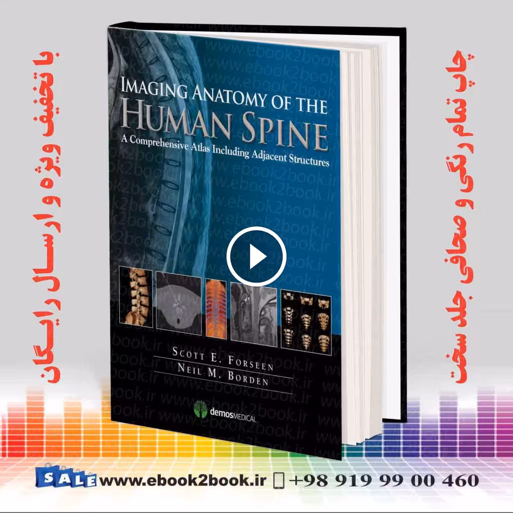 Imaging Anatomy of the Human Spine