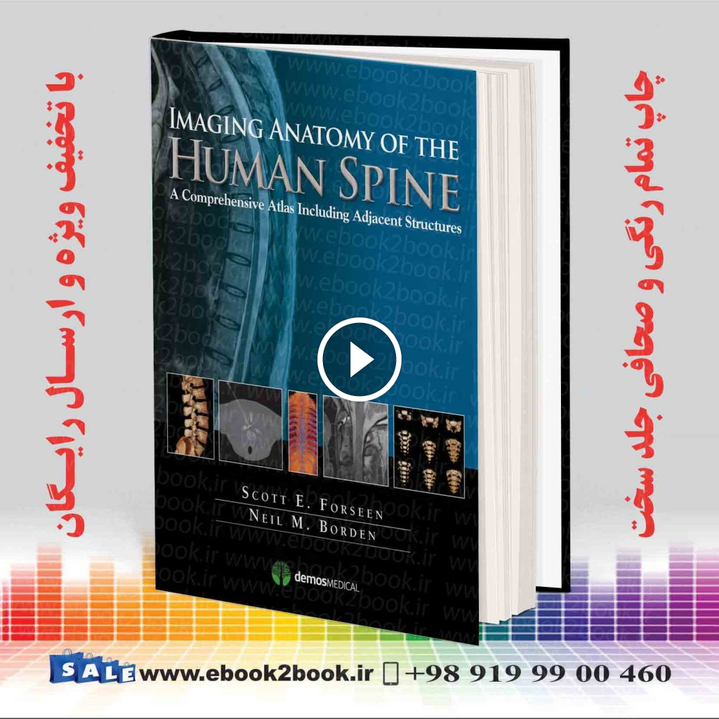 Imaging Anatomy of the Human Spine