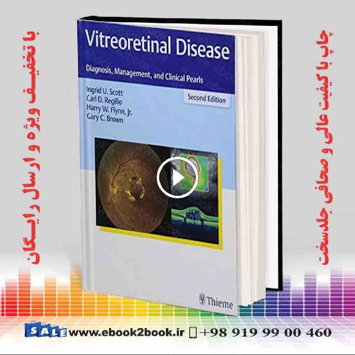 Vitreoretinal Disease: Diagnosis Management and Clinical Pearls 2nd Edition