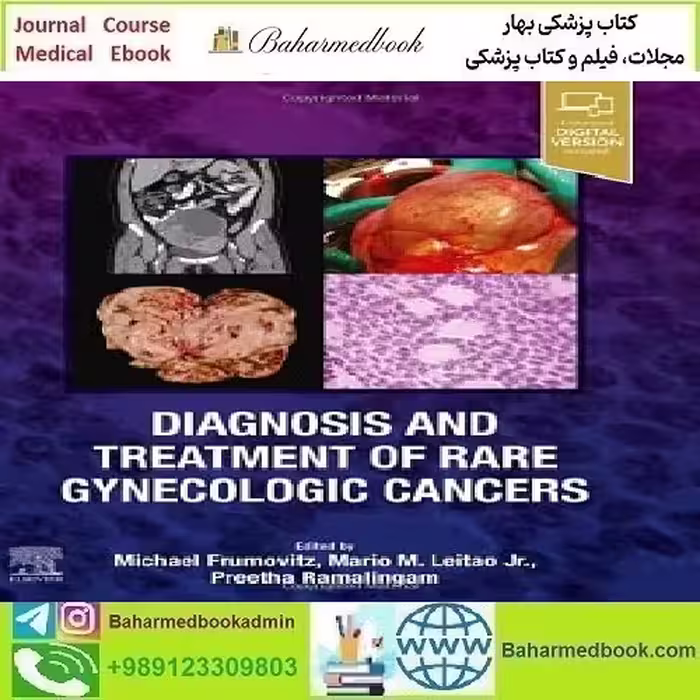 Diagnosis and Treatment of