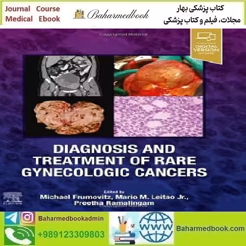 Diagnosis and Treatment of
