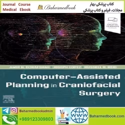 Computer Assisted Planning in Craniofacial Surgery 2024 TRUE