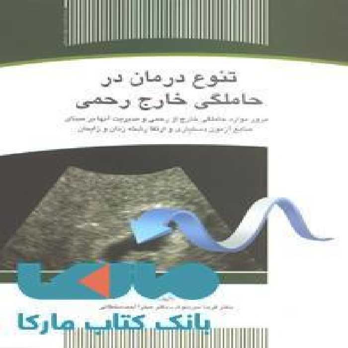 تنوع درمان در حاملگی خارج رحمی نشر جهاد دانشگاهی