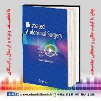 Illustrated Abdominal Surgery