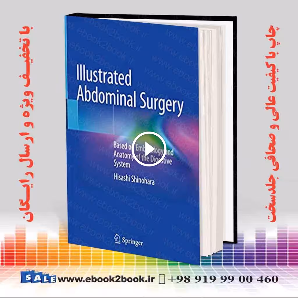 Illustrated Abdominal Surgery