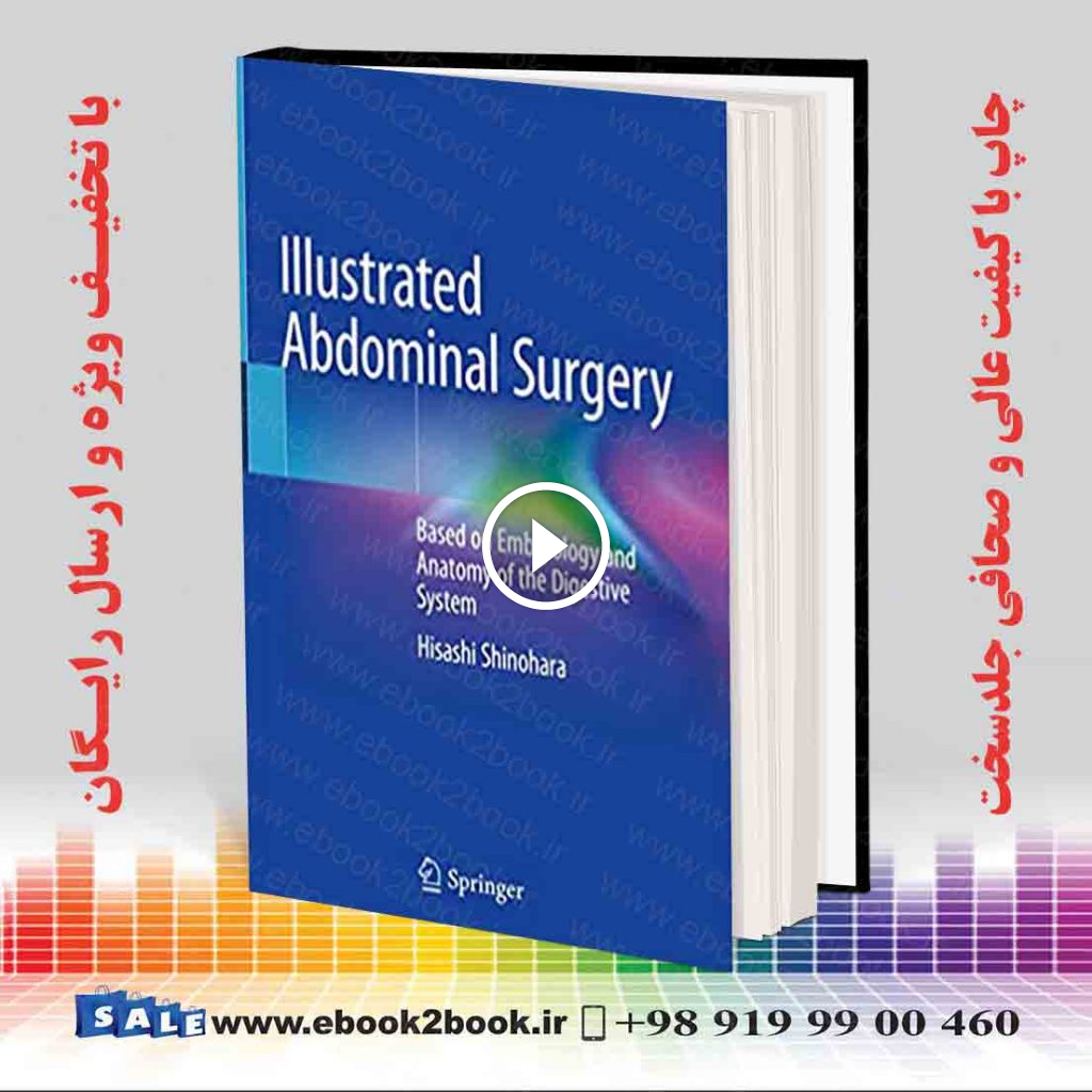 Illustrated Abdominal Surgery