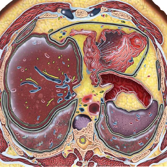 Imaging Mastery Series Benign Liver Lesions Price 15€ - کتاب پزشکی بهار