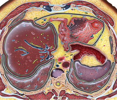 Imaging Mastery Series Benign Liver Lesions Price 15€ - کتاب پزشکی بهار