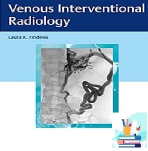 Venous Interventional Radiology TRUE PDF price 1€