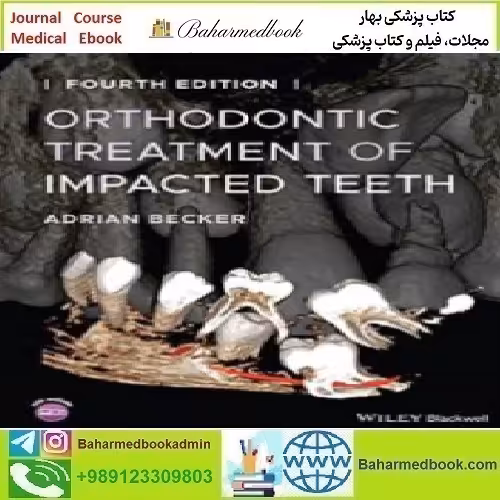 Orthodontic Treatment of Impacted Teeth 2022 TRUE PDF price 1€ - کتاب پزشکی بهار