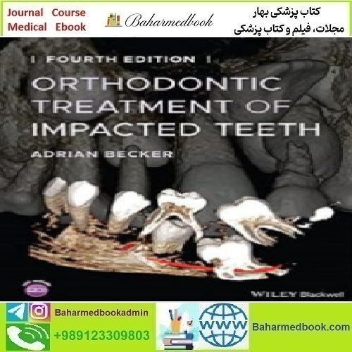 Orthodontic Treatment of Impacted Teeth 2022 TRUE PDF price 1€ - کتاب پزشکی بهار