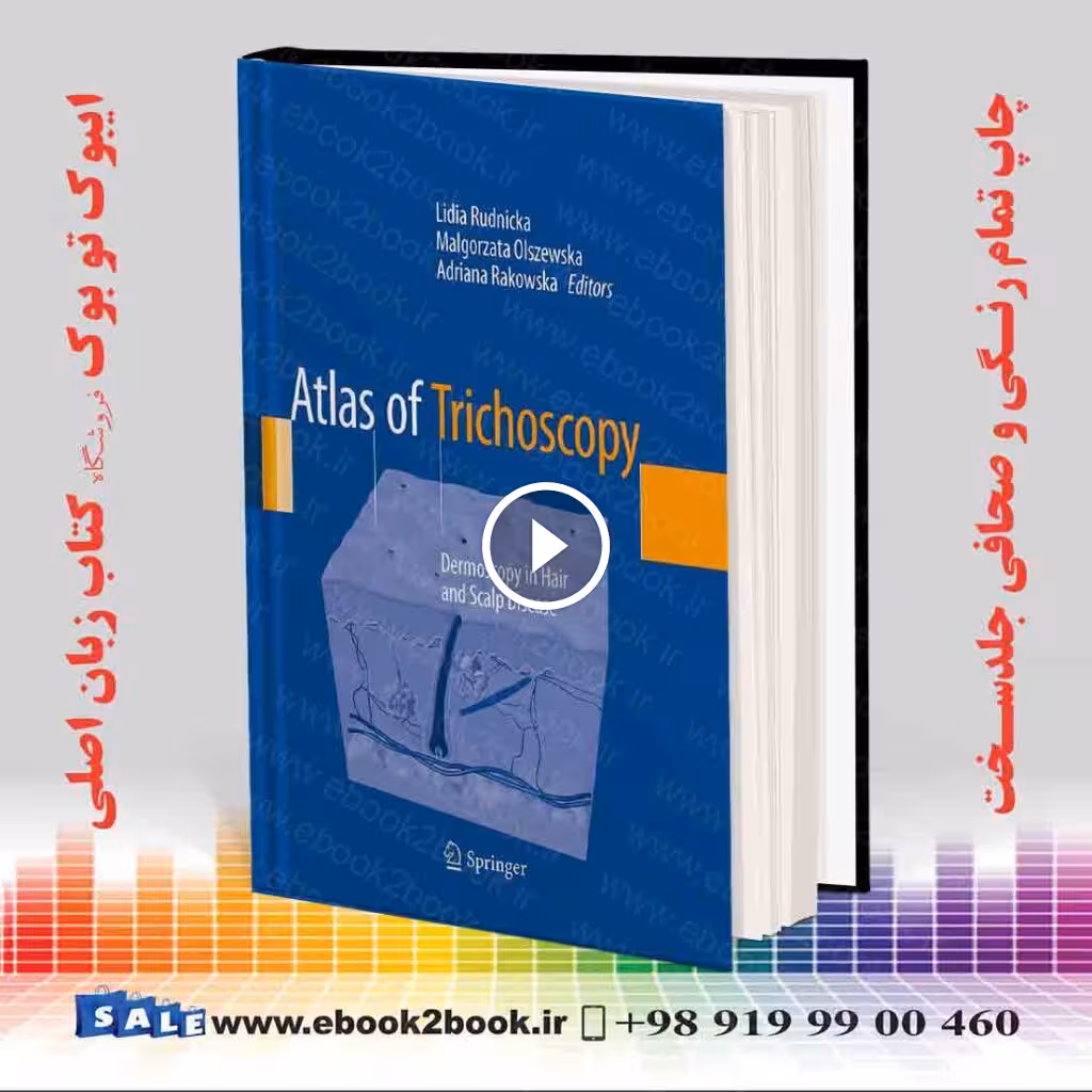 Atlas of Trichoscopy: Dermoscopy in Hair and Scalp Disease