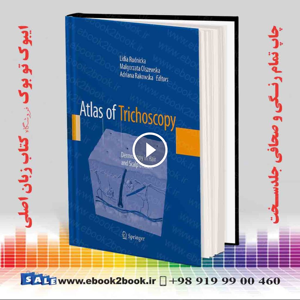 Atlas of Trichoscopy: Dermoscopy in Hair and Scalp Disease