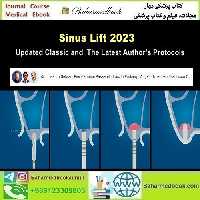 Sinus Lift 2023 Updated Classic and the Latest Author’s Protocols