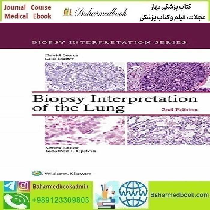 Biopsy Interpretation of the Lung 2021 CONVERTED PDF price 2€ - کتاب پزشکی بهار