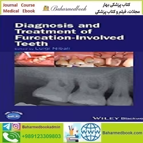 Diagnosis and Treatment of Furcation Involved Teeth 2018 TRU