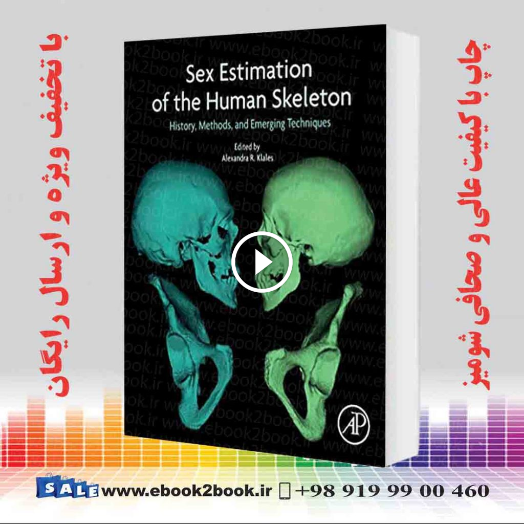 Sex Estimation of the Human Skeleton