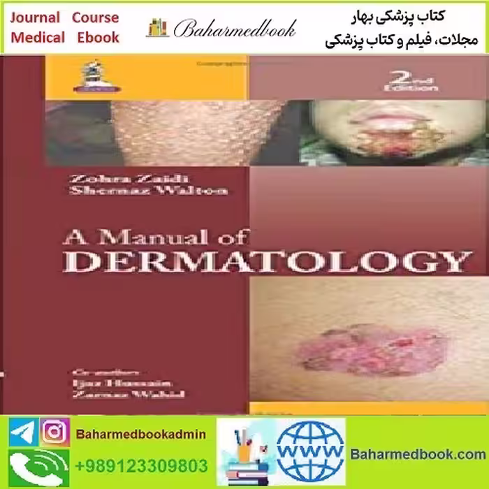A Manual of Dermatology TRUE PDF price 1€ - کتاب پزشکی بهار