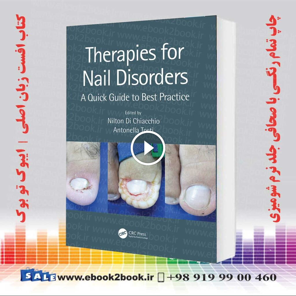 Therapies for Nail Disorders: A Quick Guide to Best Practice