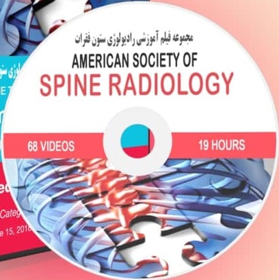 American Society of Spine Radiology 2018 Price 15€ - کتاب پزشکی بهار