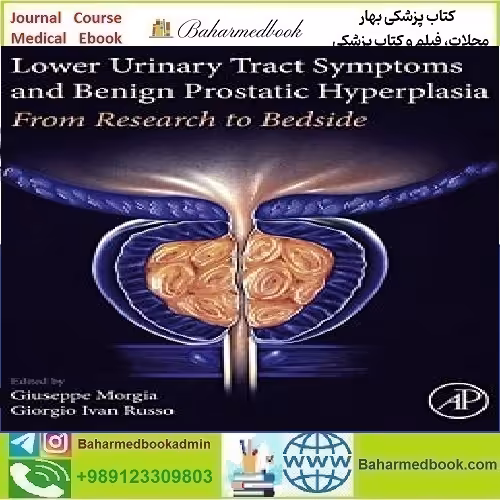 Lower Urinary Tract Symptoms and Benign Prostatic Hyperplasia