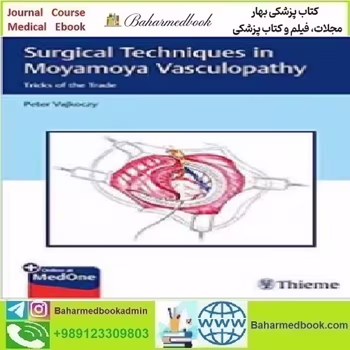 Surgical Techniques in Moyamoya Vasculopathy 2020 T