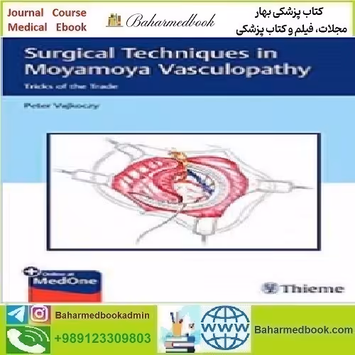 Surgical Techniques in Moyamoya Vasculopathy 2020 T